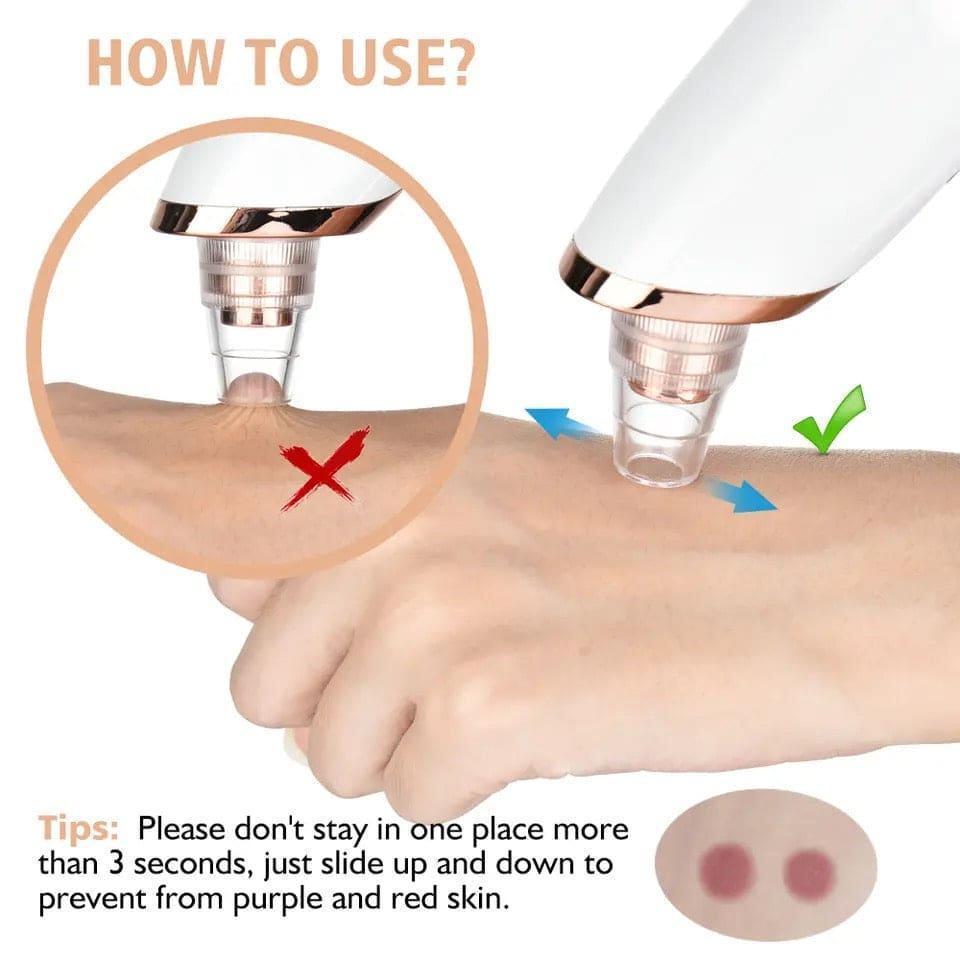Digital Blackhead Remover Vacuum Electric Pore Cleaner