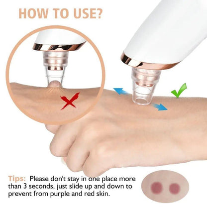 Digital Blackhead Remover Vacuum Electric Pore Cleaner